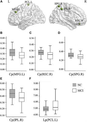 Disrupted Network Topology Contributed to Spatial Navigation Impairment in Patients With Mild Cognitive Impairment